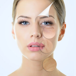 skin rejuvenation