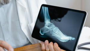 Illustrating why on-site X-rays at urgent care mean faster answers